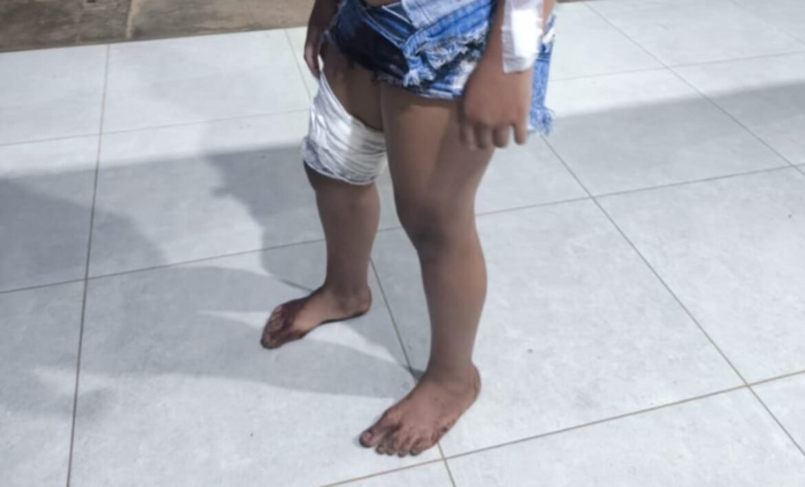 adolescente-e-esfaqueada-apos-esbarrar-em-mulher-durante-festa-em-mg adolescente-e-esfaqueada-apos-esbarrar-em-mulher-durante-festa-em-mg