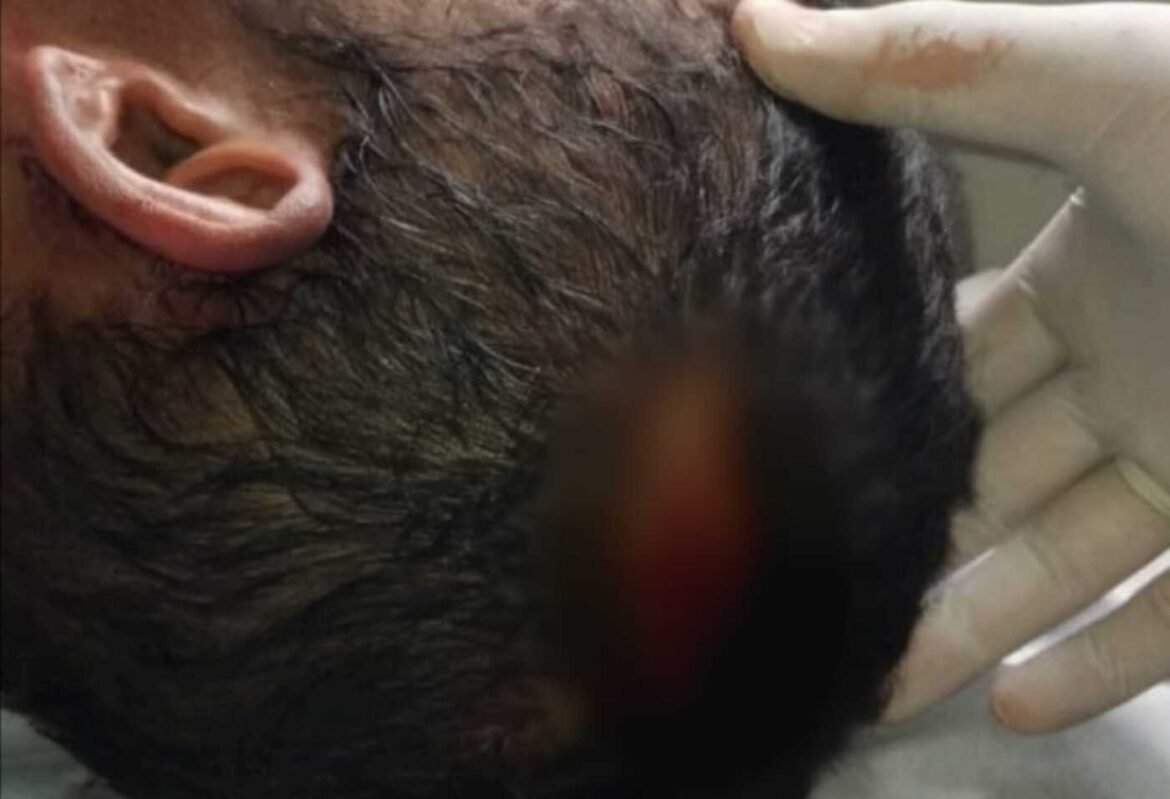 pedreiro-e-agredido-com-facao-quando-trabalhava-em-obra;-suspeito-foi-preso