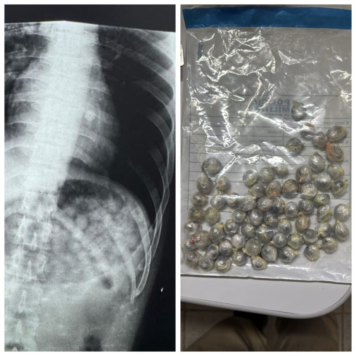 detento-em-saida-temporaria-passa-mal-apos-engolir-61-buchas-de-maconha-em-mg;-suspeita-e-que-ele-tentava-voltar-ao-presidio-com-a-droga