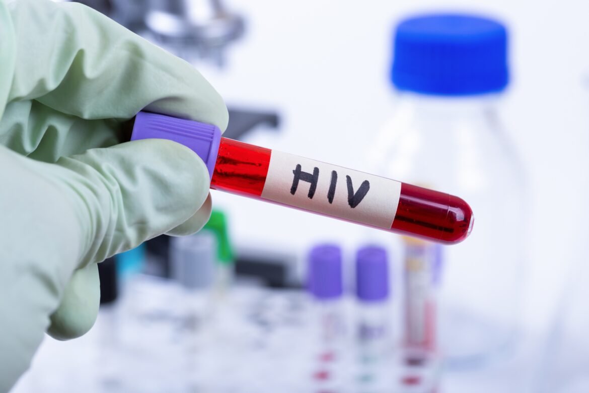 alta-nas-infeccoes-por-hiv-e-explicada-por-maior-testagem,-diz-padilha;-pais-teve-queda-na-mortalidade-pelo-virus