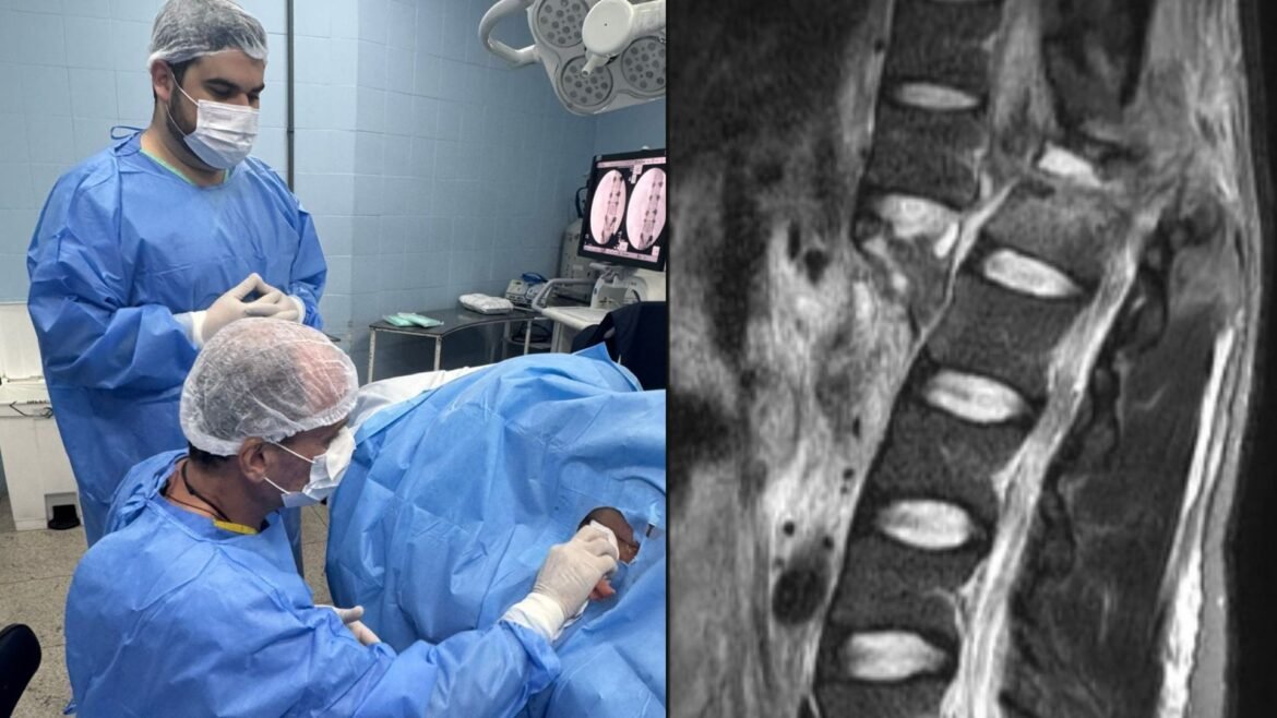 cinco-pacientes-e-janela-de-48-horas:-como-sera-a-corrida-para-aplicar-droga-experimental-em-vitimas-de-lesao-na-medula