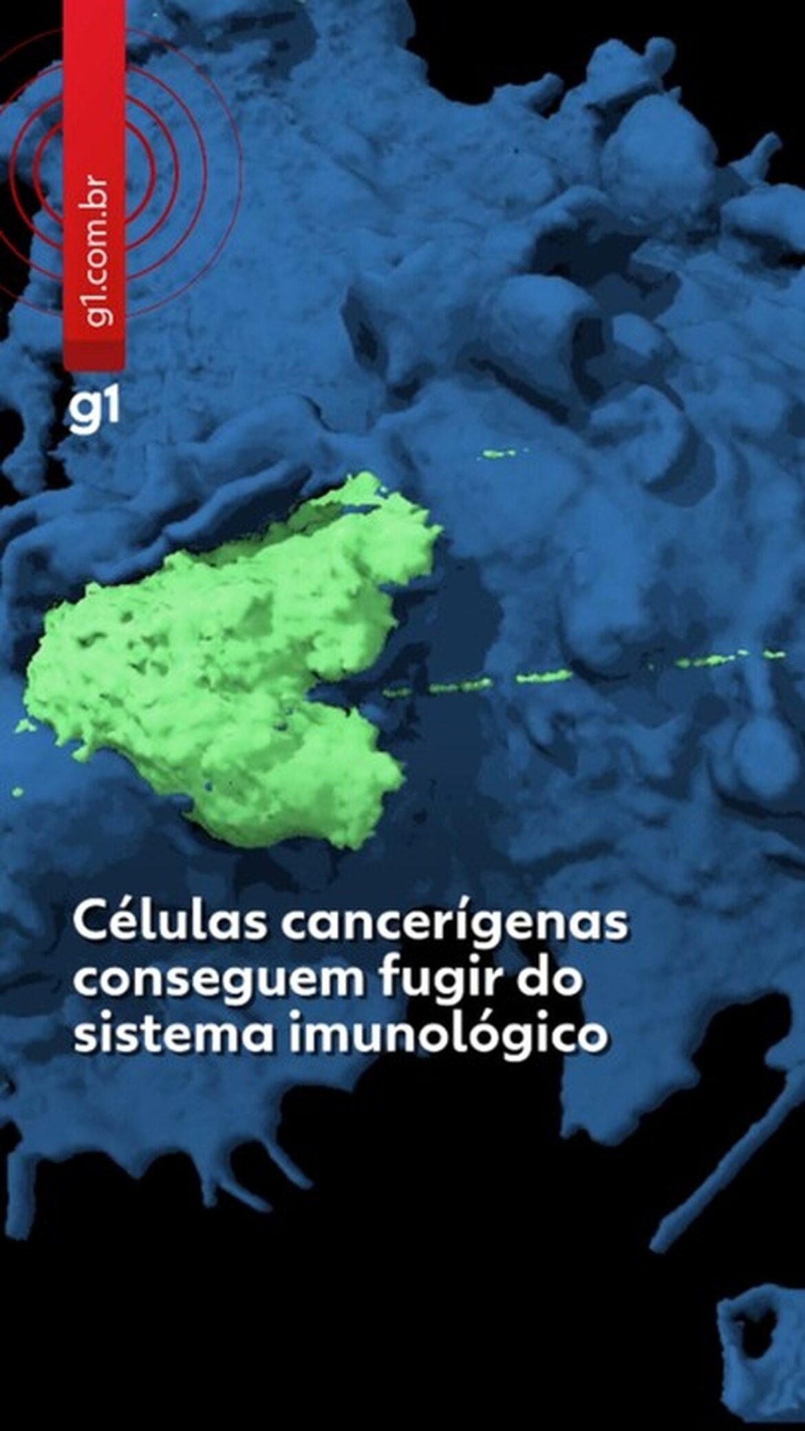 video-mostra-celulas-de-cancer-escapando-do-sistema-imunologico-e-explica-como-doenca-avanca