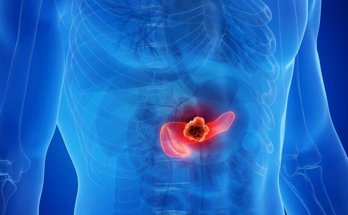 cientistas-usam-combinacao-tripla-de-medicamentos-e-eliminam-cancer-de-pancreas-em-testes-com-animais