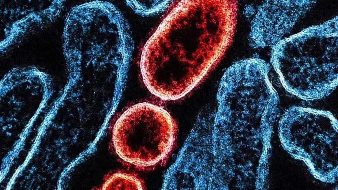 surto-de-nipah-no-carnaval?-entenda-se-ha-risco-para-o-brasil-e-quais-os-sintomas-da-doenca