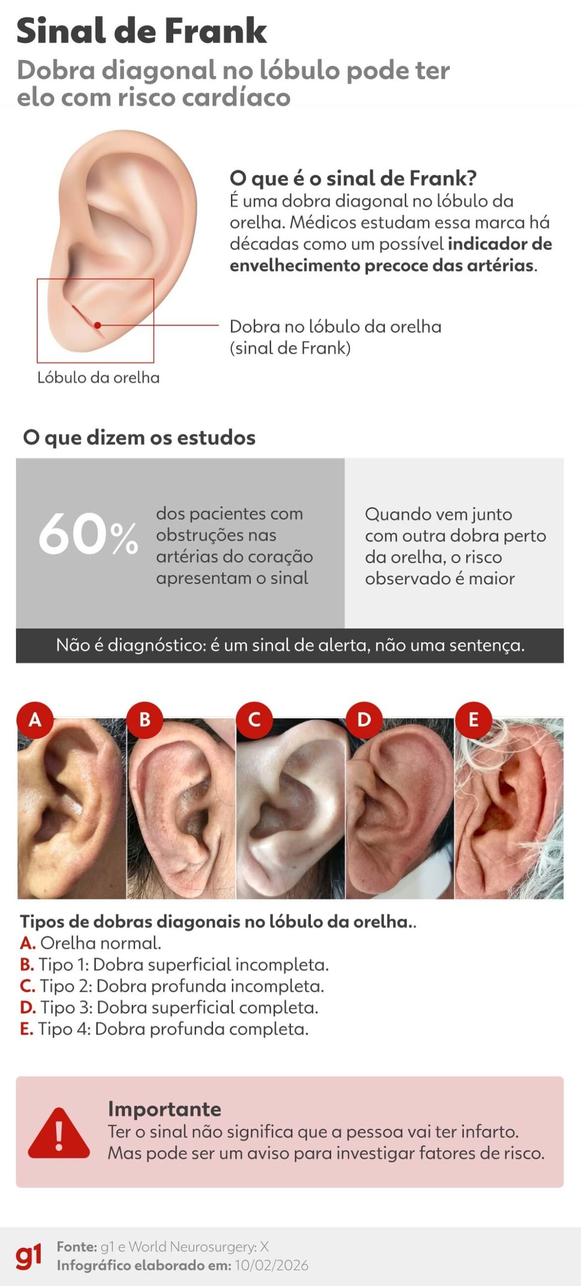 dobra-na-orelha:-o-que-fazer-se-voce-tem-o-sinal-de-frank-e-quais-os-riscos-de-problema-no-coracao
