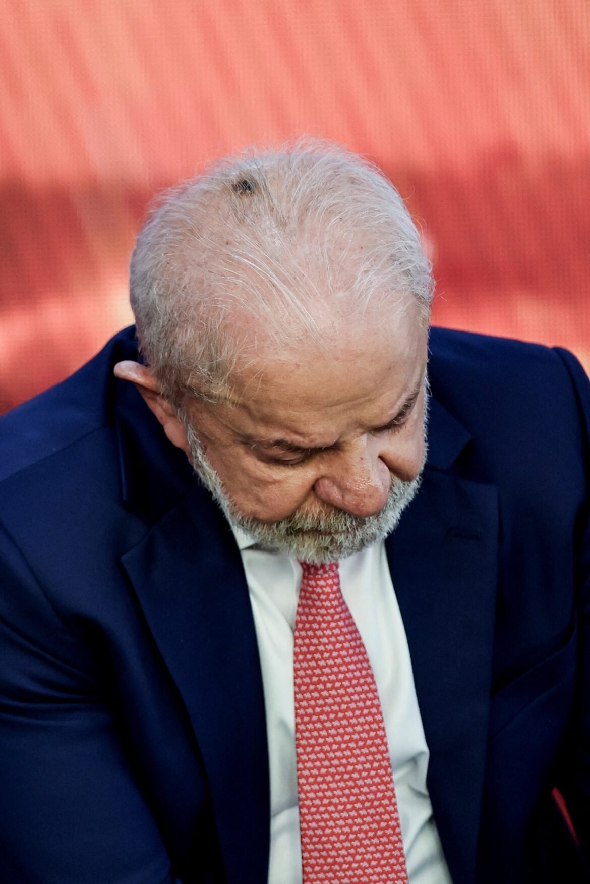 queratose:-lula-faz-procedimento-dermatologico-simples-e-aparece-com-marca-na-cabeca;-entenda-a-condicao