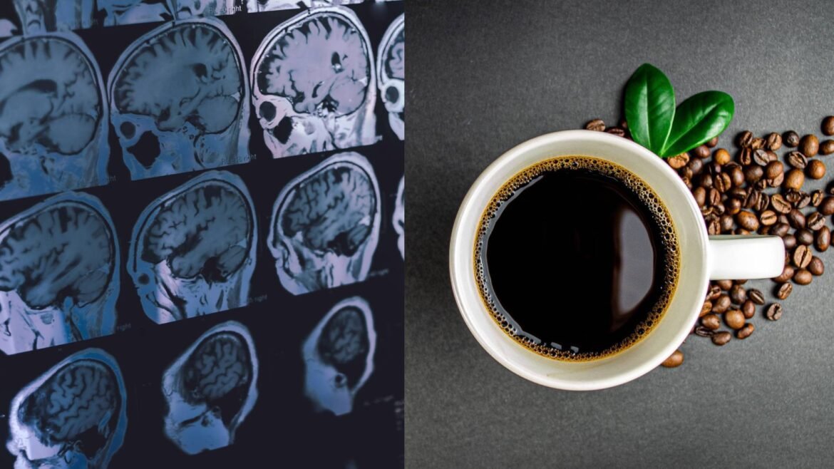 cafe-pode-reduzir-a-chance-de-demencia,-diz-estudo