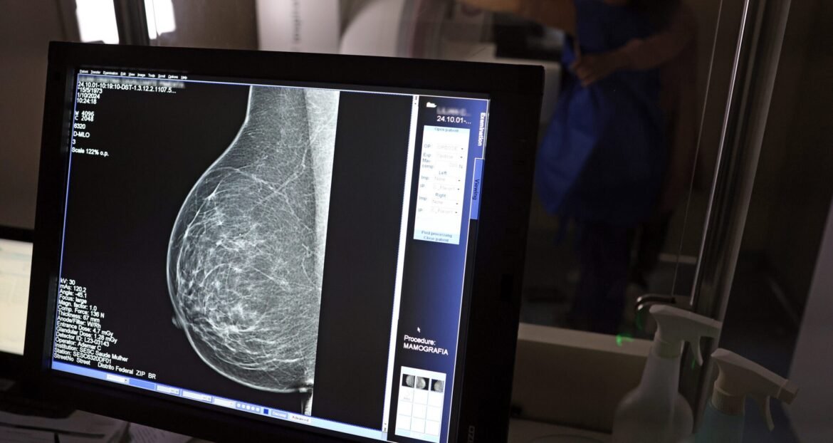 ia-pode-identificar-risco-de-doencas-cardiacas-graves-a-partir-de-mamografias;-entenda-relacao