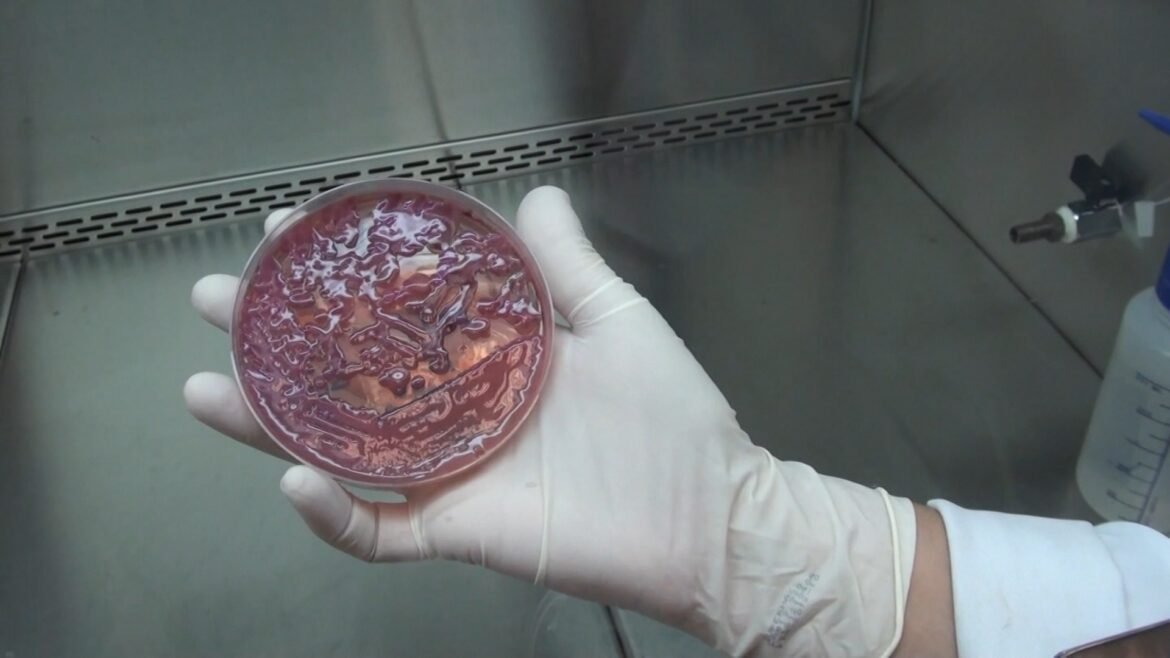 kpc:-o-que-e-a-superbacteria-resistente-a-antibioticos-que-levou-hospital-a-esvaziar-uti