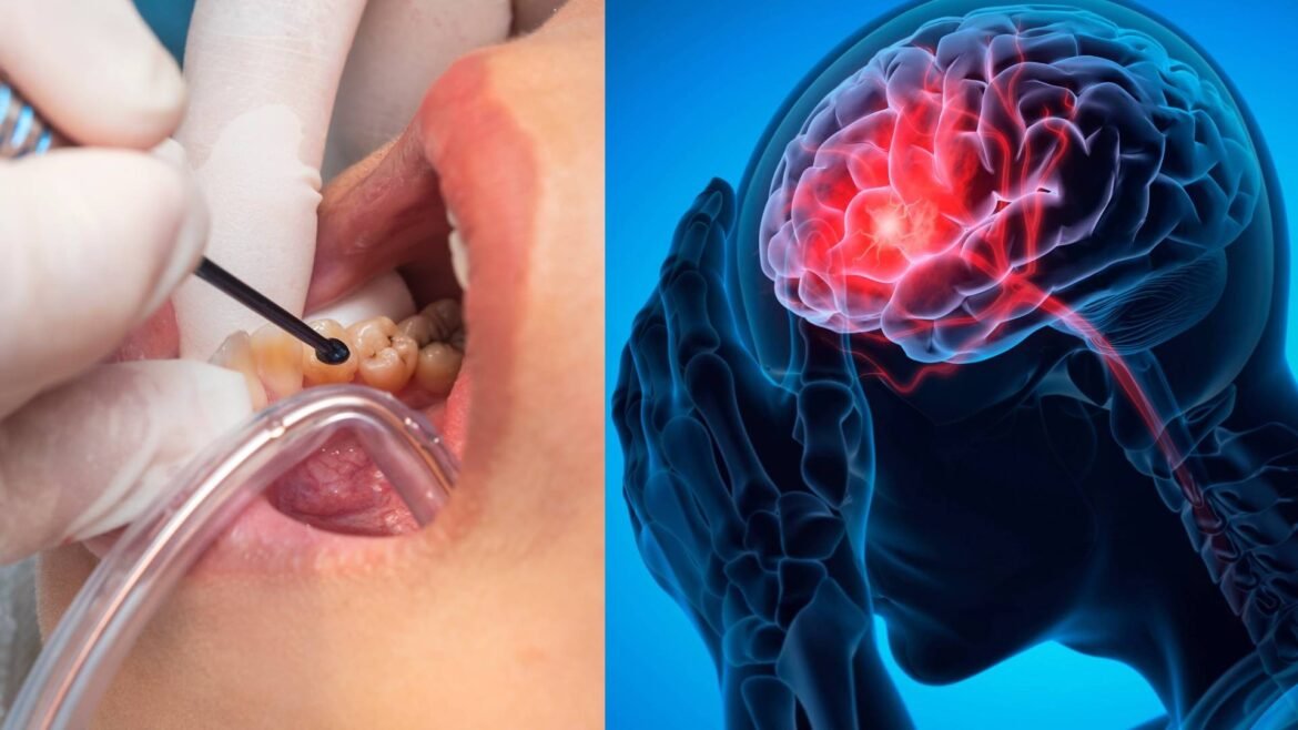 o-que-carie-e-gengivite-tem-a-ver-com-avc?-estudo-indica-aumento-significativo-no-risco-de-derrame