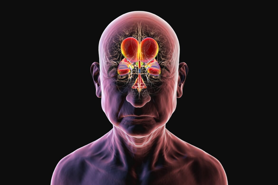 hidrocefalia-de-pressao-normal-(hpn):-condicao-neurologica-pode-imitar-alzheimer,-mas-tem-chance-de-reversao