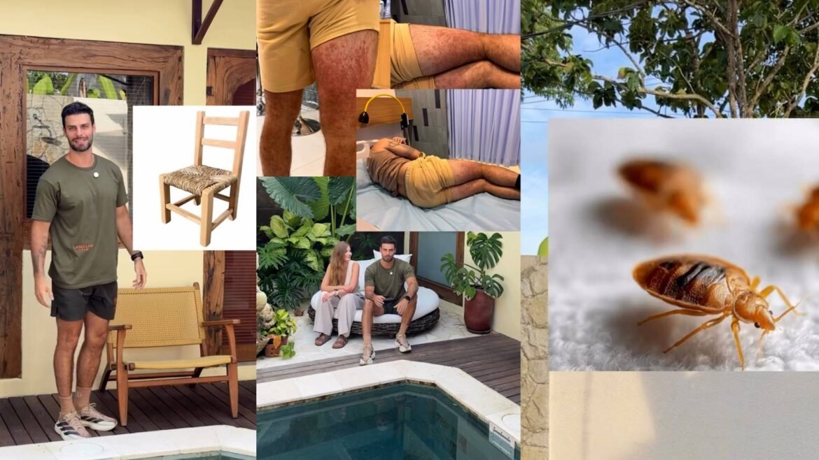 ator-lucas-malvacini-relata-susto-em-bali-apos-reacao-alergica-a-inseto;-saiba-como-prevenir-e-tratar