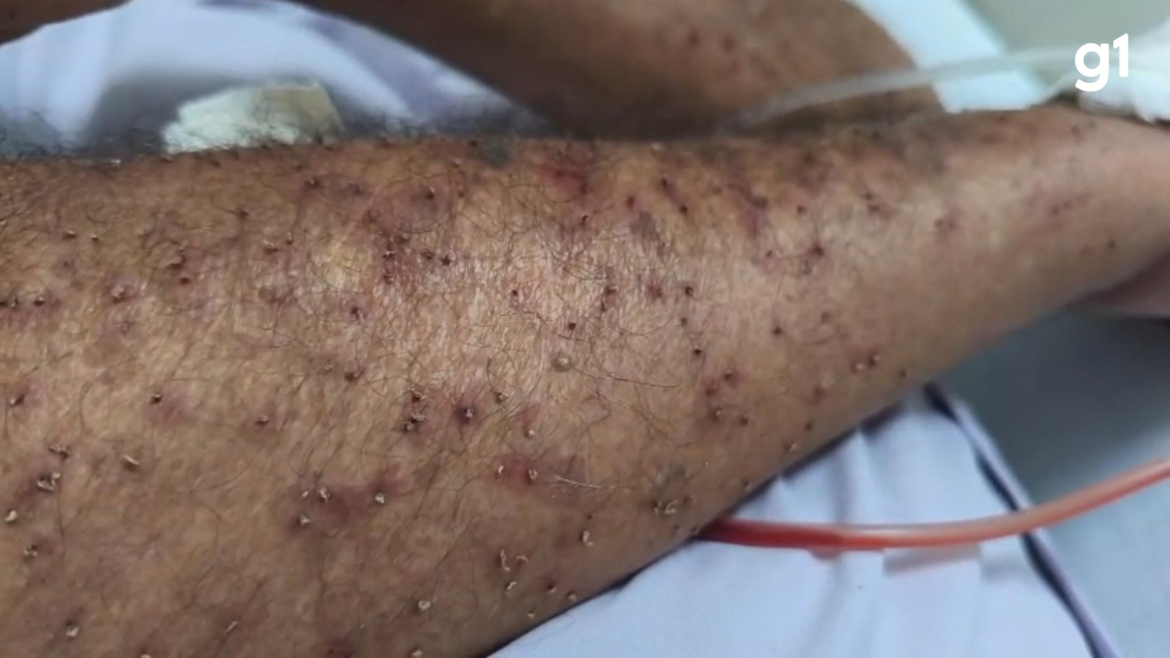 idoso-atacado-por-enxame-de-abelhas-morre-no-vale-do-jequitinhonha