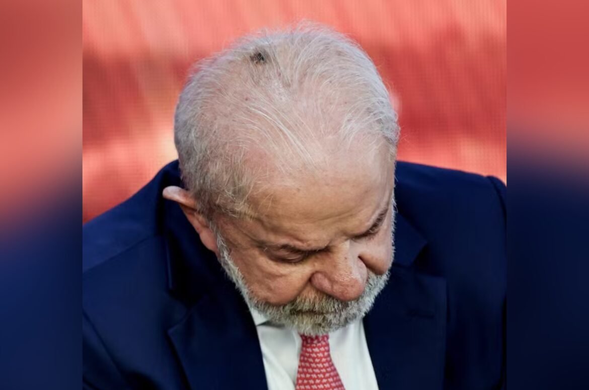 lula-fara-retirada-de-acumulo-de-pele-na-cabeca-e-infiltracao-no-punho-para-tratar-tendinite,-diz-planalto