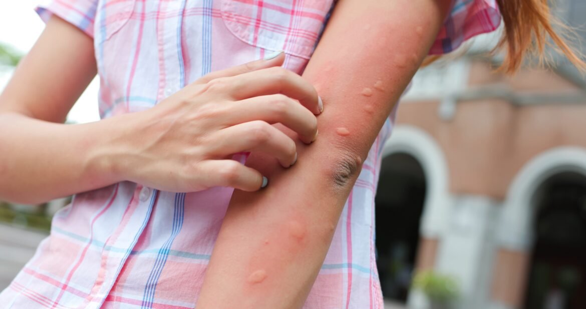 malaria-pode-ter-moldado-evolucao-humana,-aponta-estudo