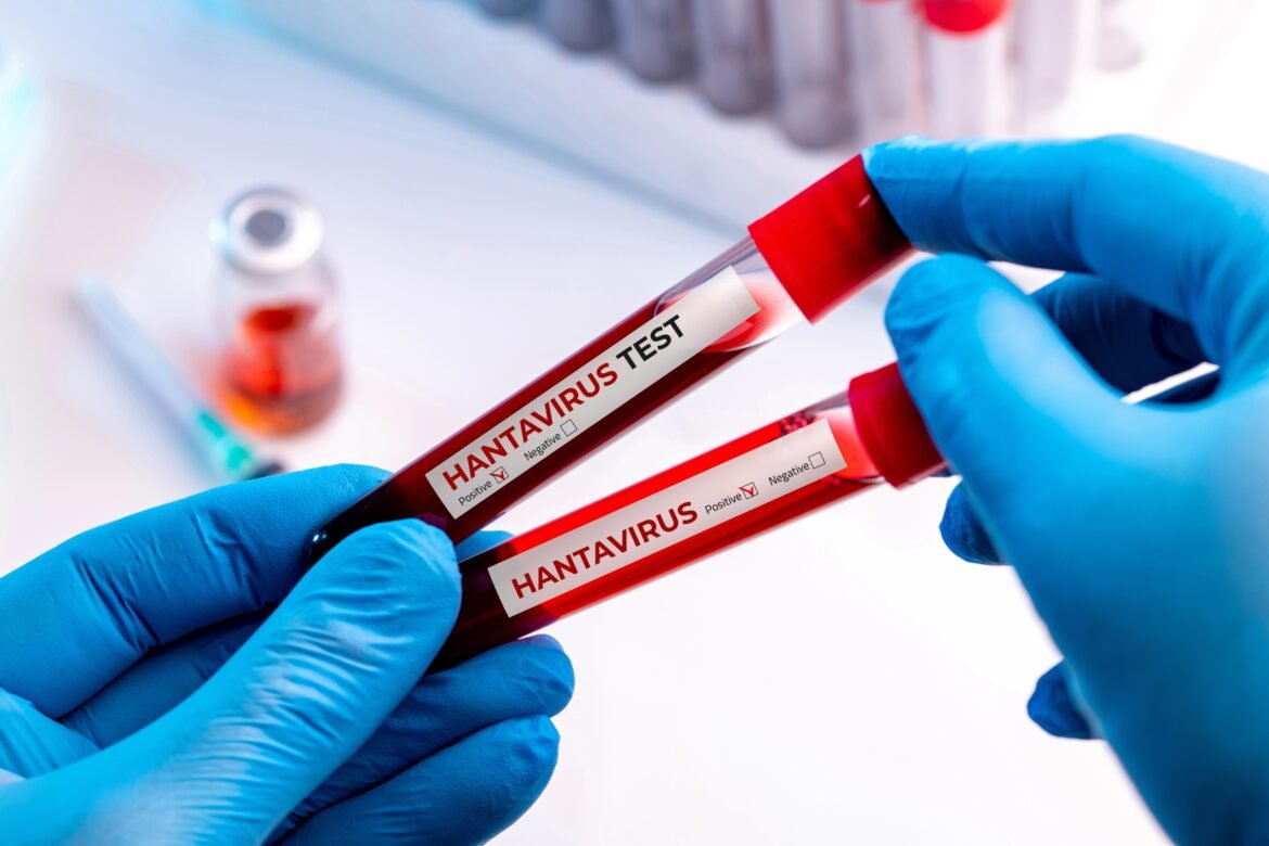 oms-preve-novos-casos-de-hantavirus,-mas-espera-que-surto-em-navio-seja-‘limitado’