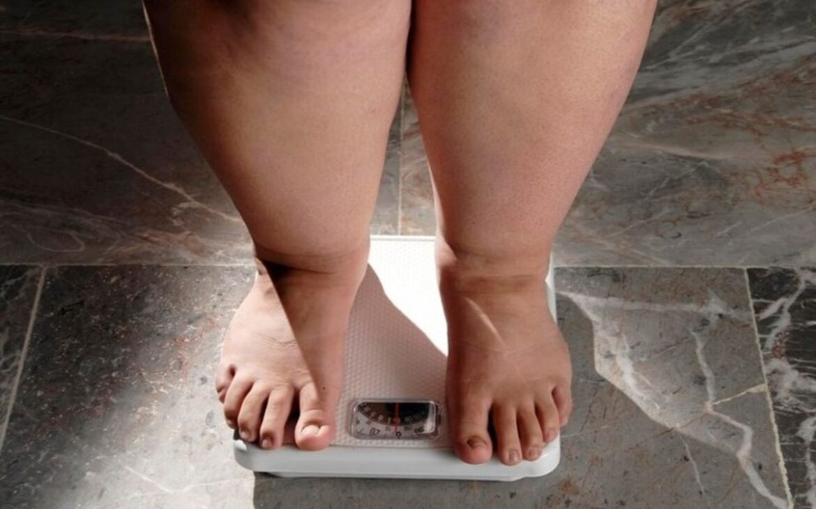 suplemento-com-bacteria-presente-no-intestino-pode-ajudar-no-controle-do-peso,-mostra-estudo