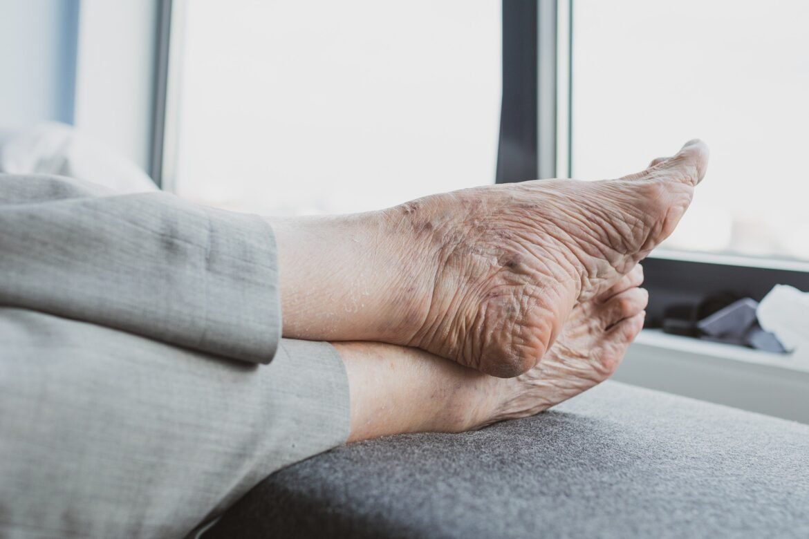 voce-consegue-cortar-as-proprias-unhas-dos-pes?
