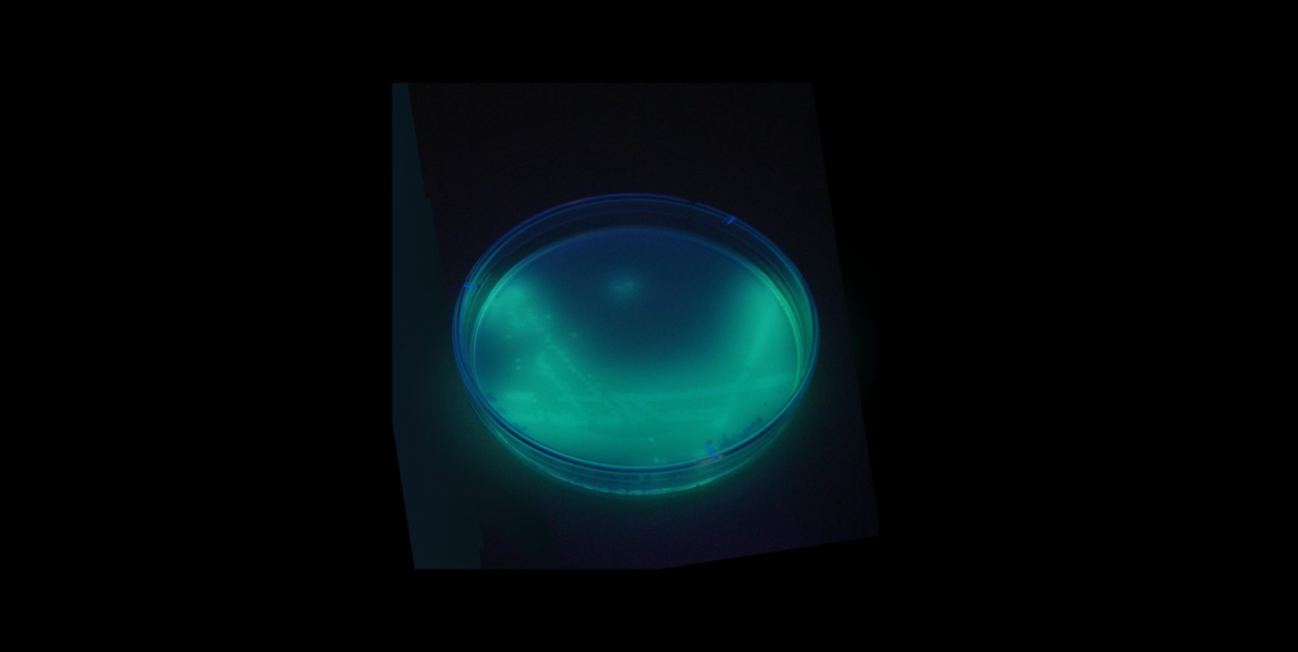 bacteria-pseudomonas-aeruginosa-foi-identificada-em-mais-de-100-lotes-de-produtos-ype-em-inspecao-de-abril,-diz-anvisa