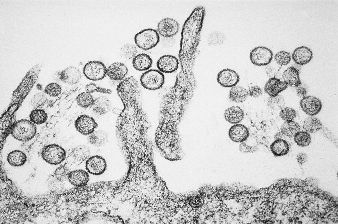 hantavirus:-testes-feitos-em-pacientes-suspeitos-na-italia-e-na-espanha-dao-negativo;-oms-afasta-risco-de-pandemia