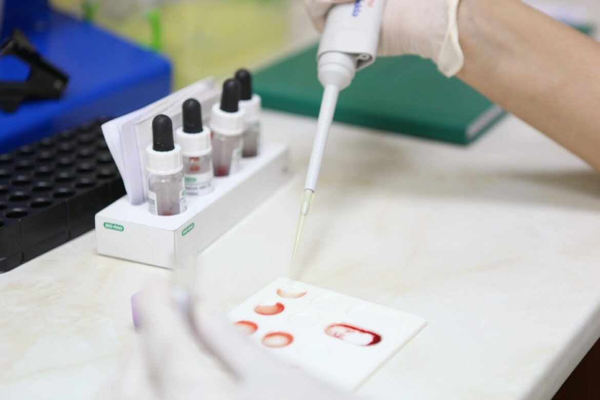 exame-de-sangue-pode-detectar-sinais-de-alzheimer-anos-antes-dos-sintomas,-diz-estudo