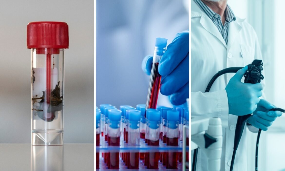 exames-de-fezes-e-sangue-se-juntam-a-colonoscopia-como-opcoes-para-rastreamento-de-cancer-colorretal