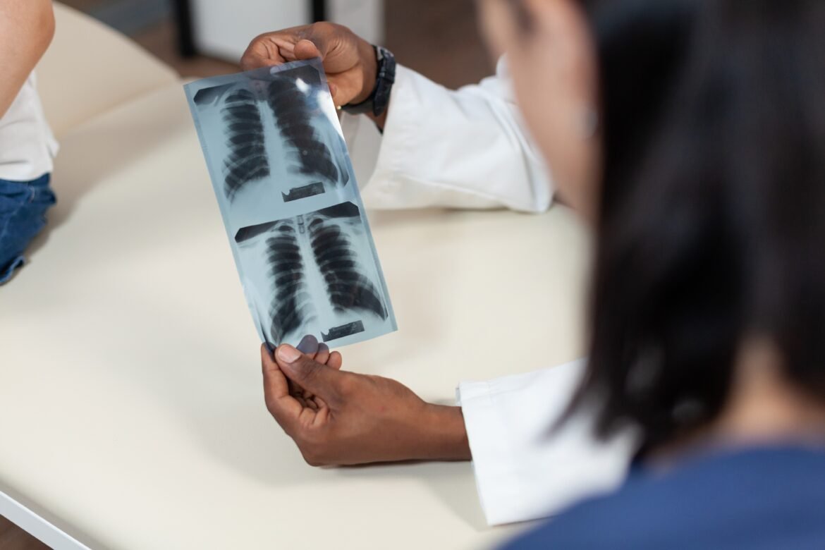 paciente-do-sus-com-cancer-de-pulmao-vive-menos-por-falta-de-acesso-ao-tratamento-mais-indicado