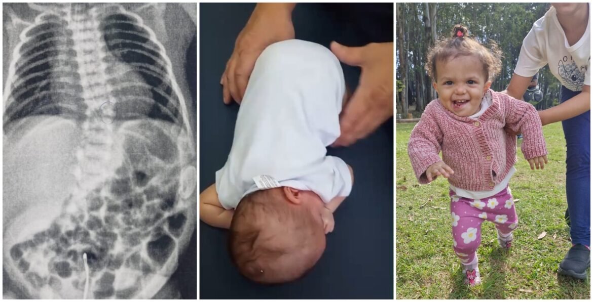 como-a-fisioterapia-precoce-mudou-a-trajetoria-de-bebe-prematura-com-risco-de-nao-andar-nem-falar-em-sp