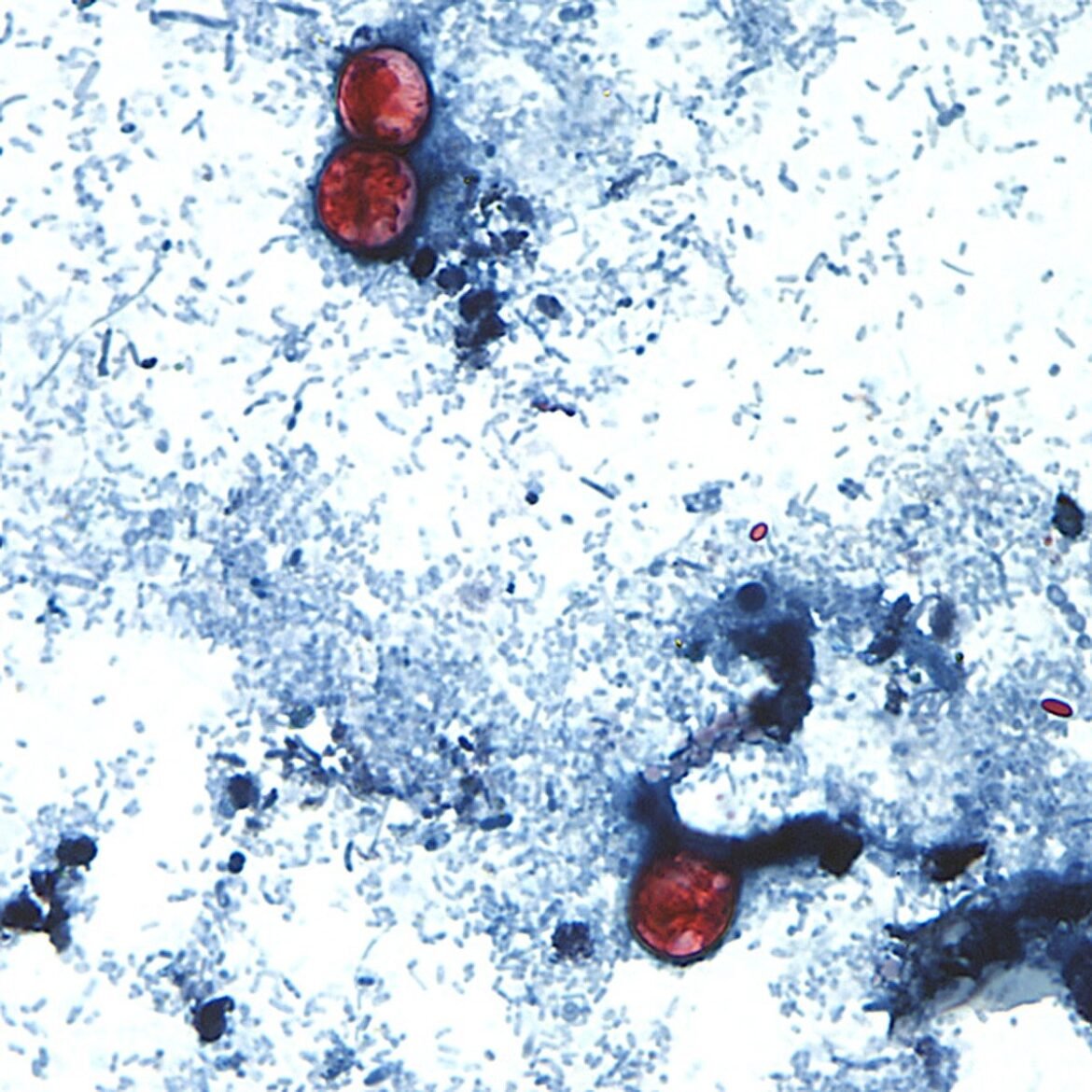 parasita-que-provoca-‘diarreia-explosiva’-infecta-mais-de-2,8-mil-pessoas-nos-eua;-investigacao-aponta-alface-como-suspeita
