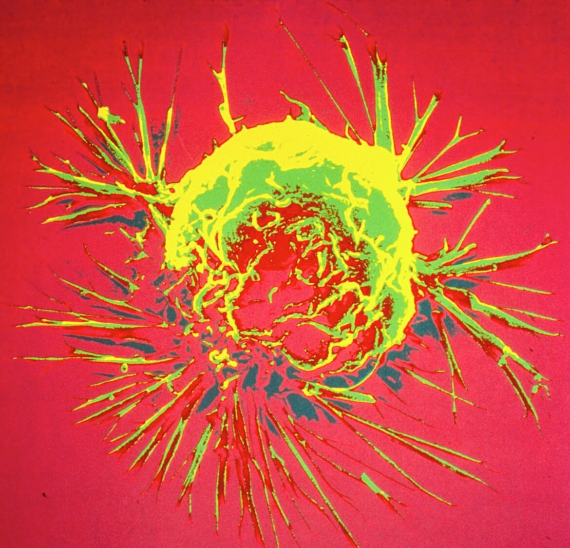cientistas-modificam-bacterias-para-combater-cancer