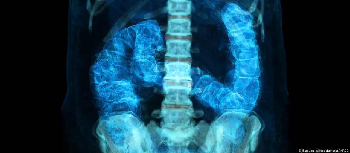 diagnostico-precoce-pode-curar-mais-de-90%-dos-casos-de-cancer-de-intestino;-veja-os-sinais-de-alerta