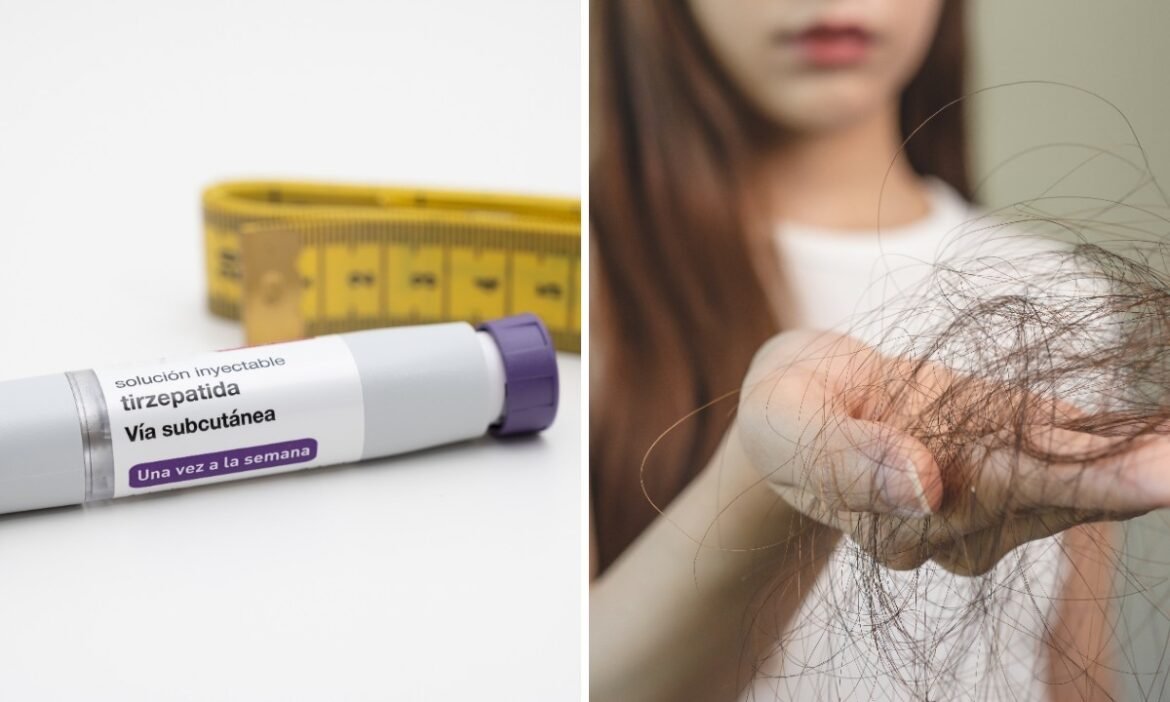 queda-de-cabelo-com-canetas-emagrecedoras:-por-que-ocorre-e-como-prevenir