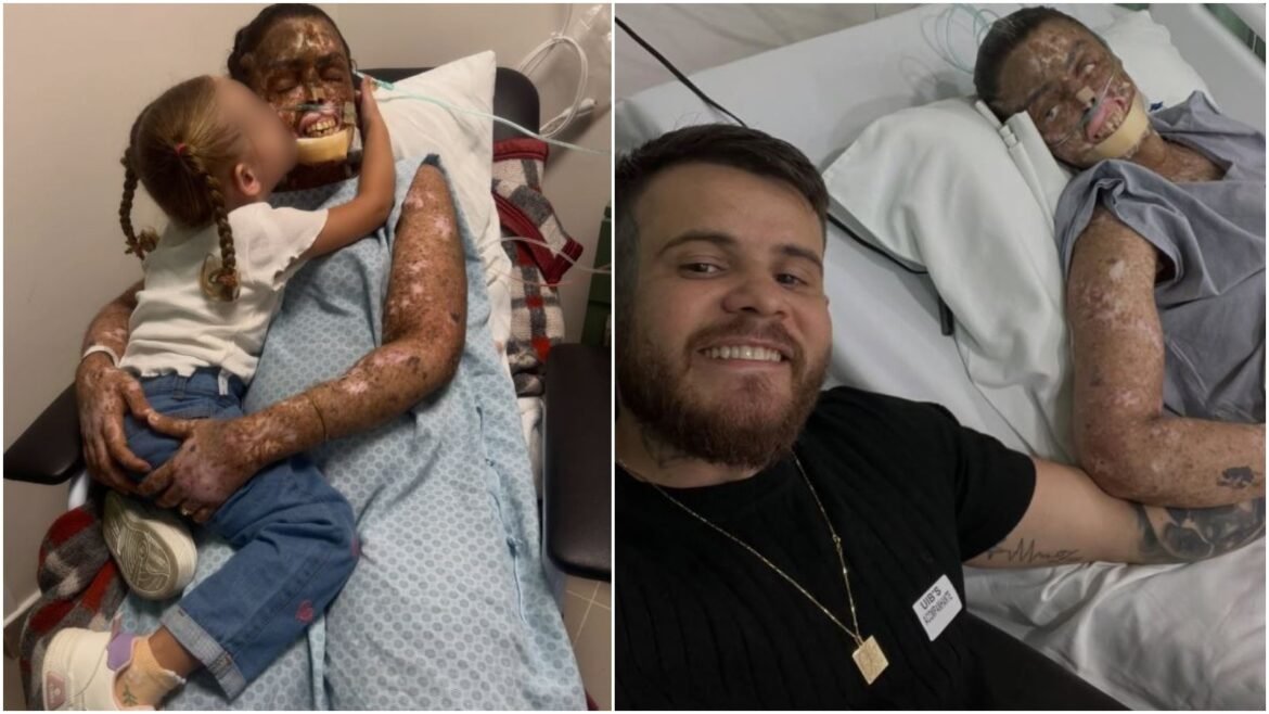 o-que-e-o-xeroderma-pigmentoso,-a-doenca-rara-que-faz-do-sol-um-risco-de-cancer-e-causou-a-morte-de-kah-felipe