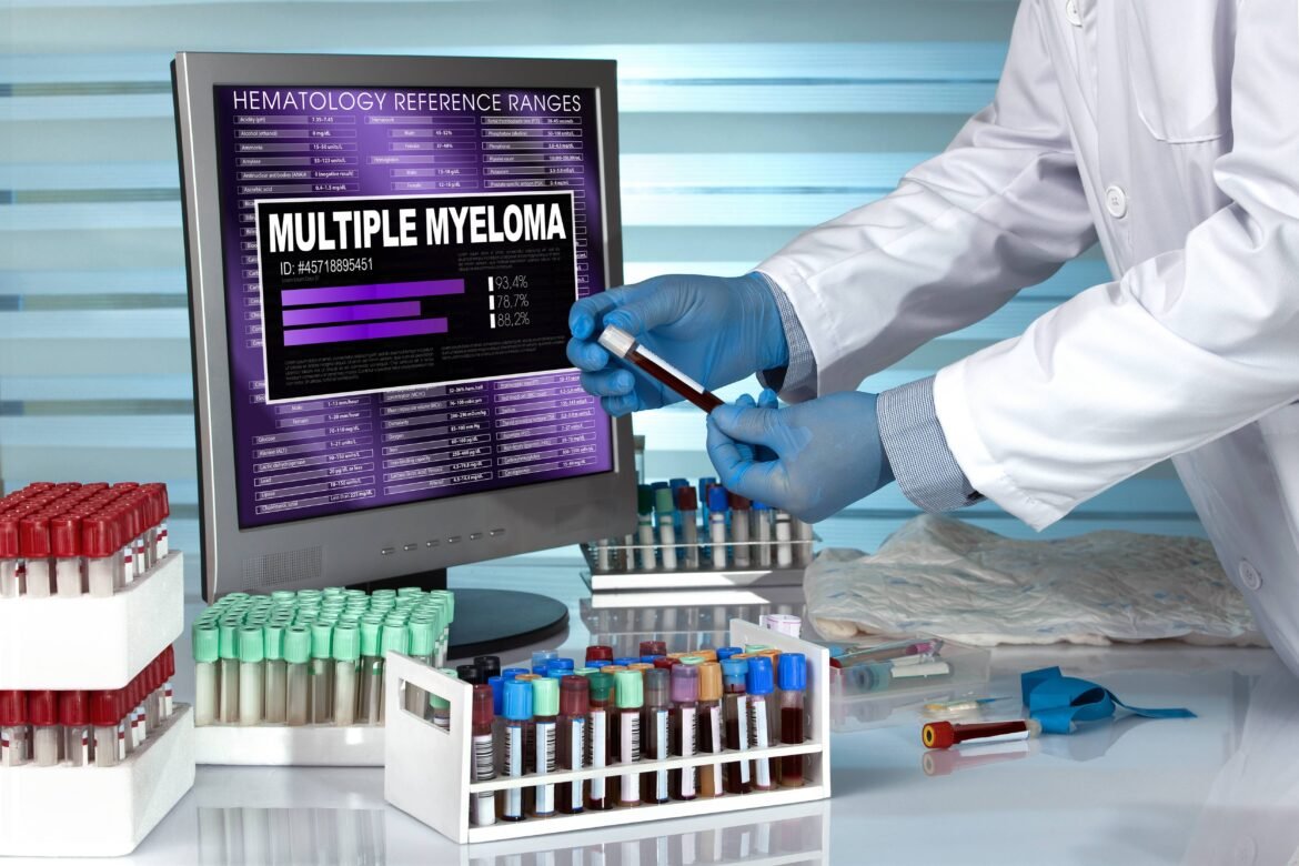 com-novos-tratamentos,-estudo-propoe-mudar-criterio-para-identificar-pacientes-com-forma-mais-grave-de-mieloma-multiplo