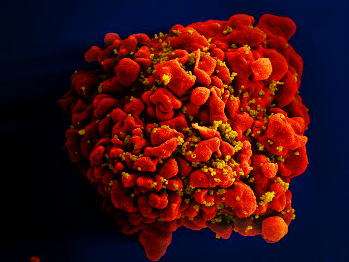 hiv:-dois-novos-casos-de-cura-sao-anunciados;-total-chega-a-13