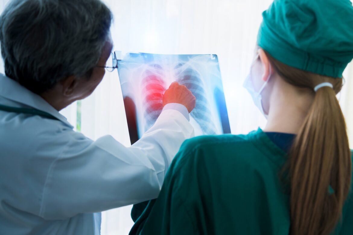 anvisa-aprova-novo-medicamento-para-cancer-de-pulmao