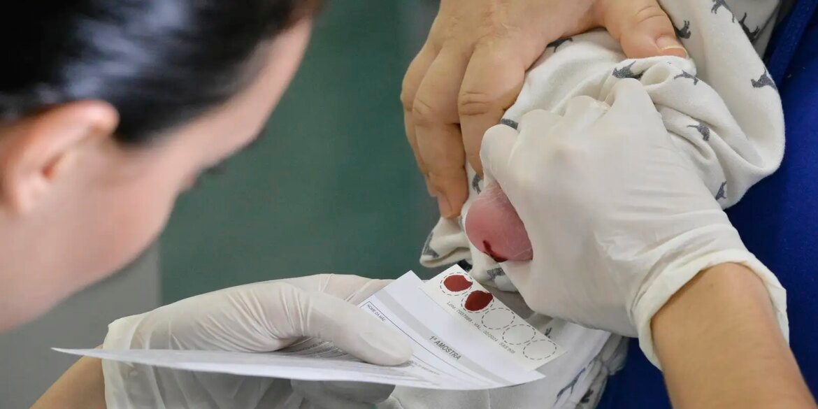 atraso-na-ampliacao-do-teste-do-pezinho-dificulta-diagnostico-da-ame