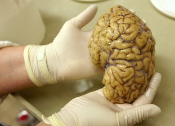 o-paralelo-entre-cerebro-x-smartphone:-estudo-aponta-que-orgao-e-formado-por-‘pecas’-de-diferentes-origens