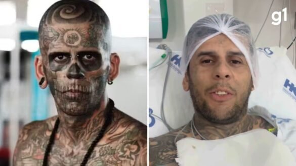 cancer-de-bexiga-invasivo:-entenda-tratamento-e-prognostico-de-doenca-que-atinge-‘homem-mais-tatuado-do-brasil’
