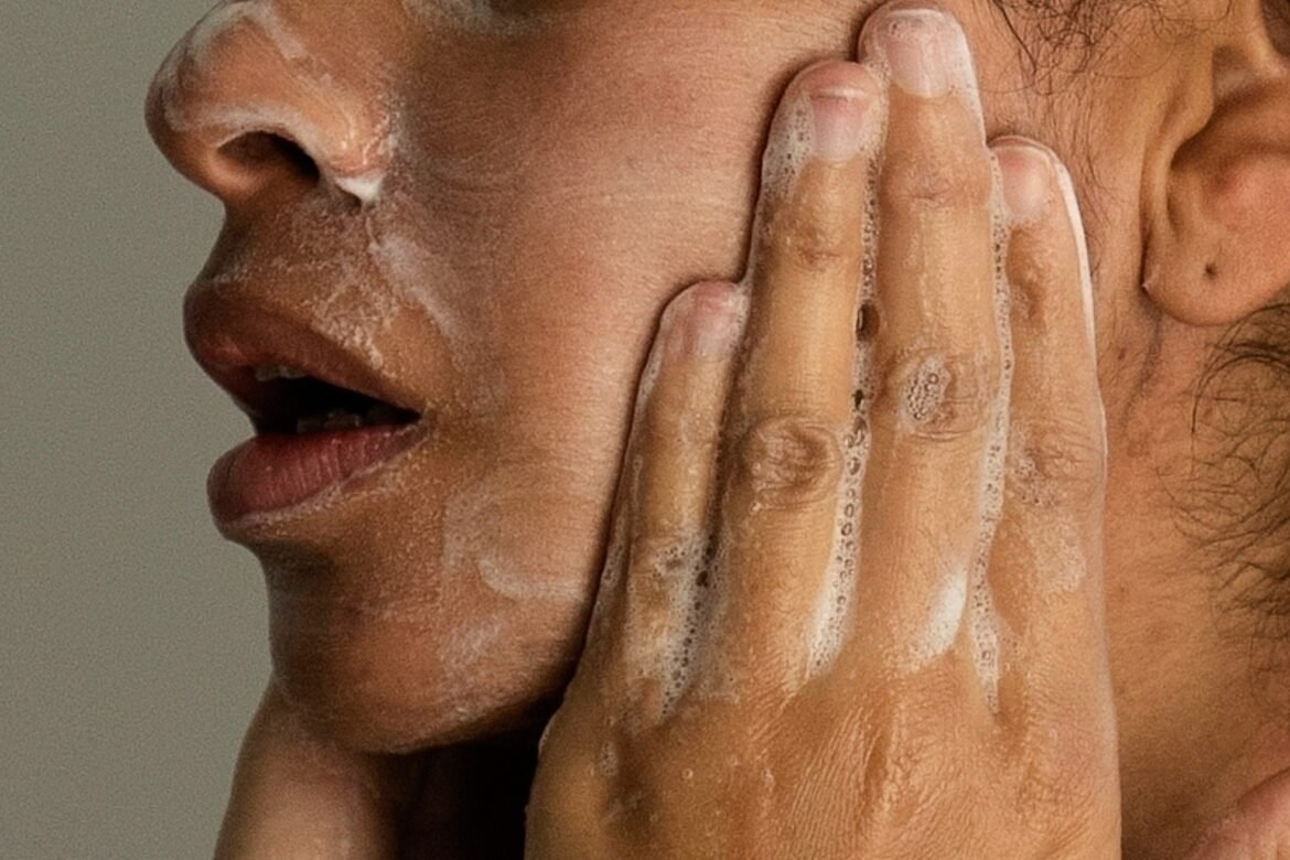 acne-na-vida-adulta:-por-que-as-espinhas-aparecem-depois-dos-30-anos-e-como-tratar?
