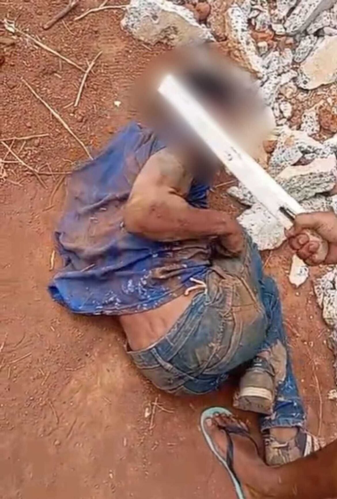 suspeito-e-preso-apos-homem-ser-torturado-como-‘castigo’-pelo-trafico-em-janauba