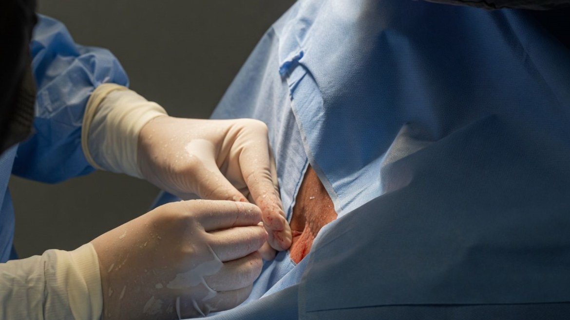 anvisa-registra-9-mortes-em-uso-compassivo-de-polilaminina-e-impoe-restricoes;-pesquisadora-questiona