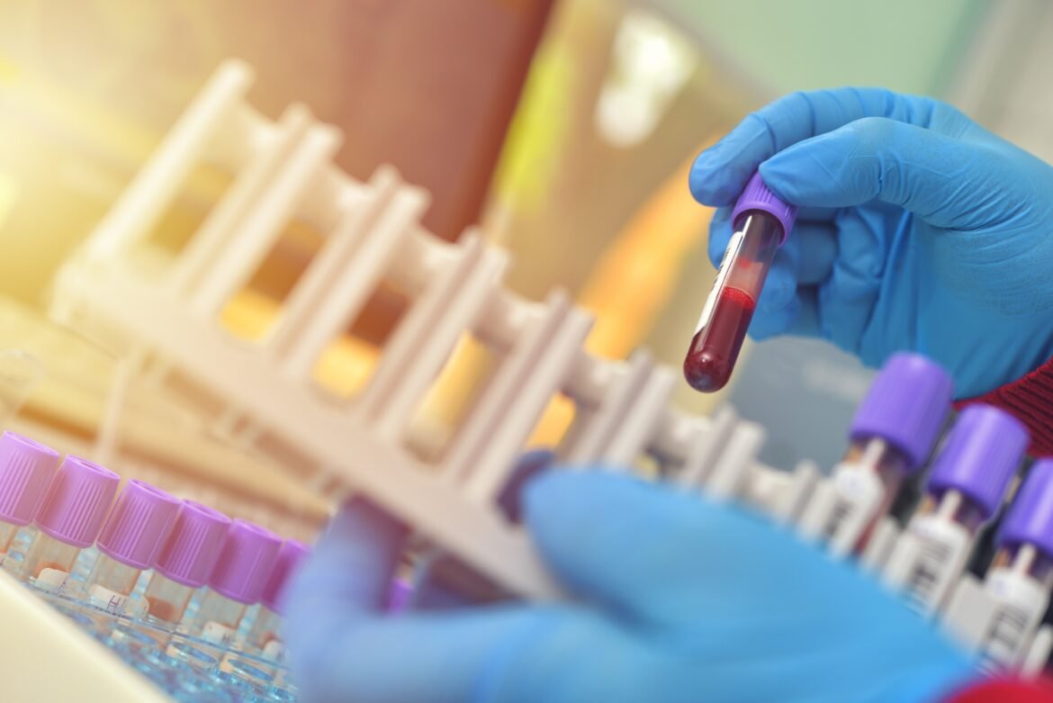 pesquisa-com-mais-de-28-mil-pessoas-descobre-‘freio’-que-pode-ser-chave-para-novos-tratamentos-de-doencas-hereditarias-do-sangue