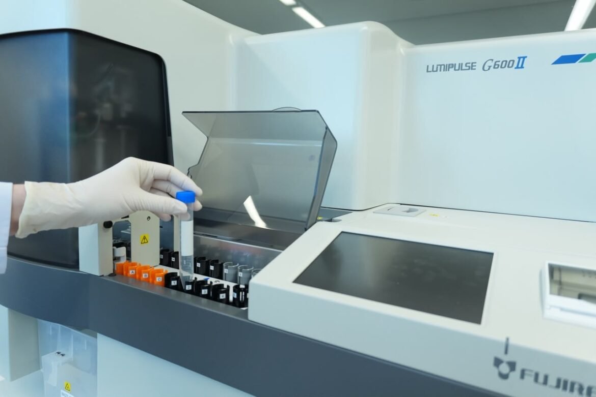 primeiro-exame-de-sangue-para-alzheimer-com-registro-na-anvisa-chega-ao-brasil:-veja-quem-pode-fazer,-quanto-custa-e-o-que-o-resultado-revela